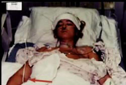 Darlie is in a hospital bed after being attacked. There are bandages on her forehead and chest.
