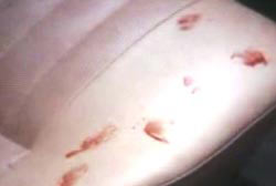 There are multiple blood stains on the seat of the car.